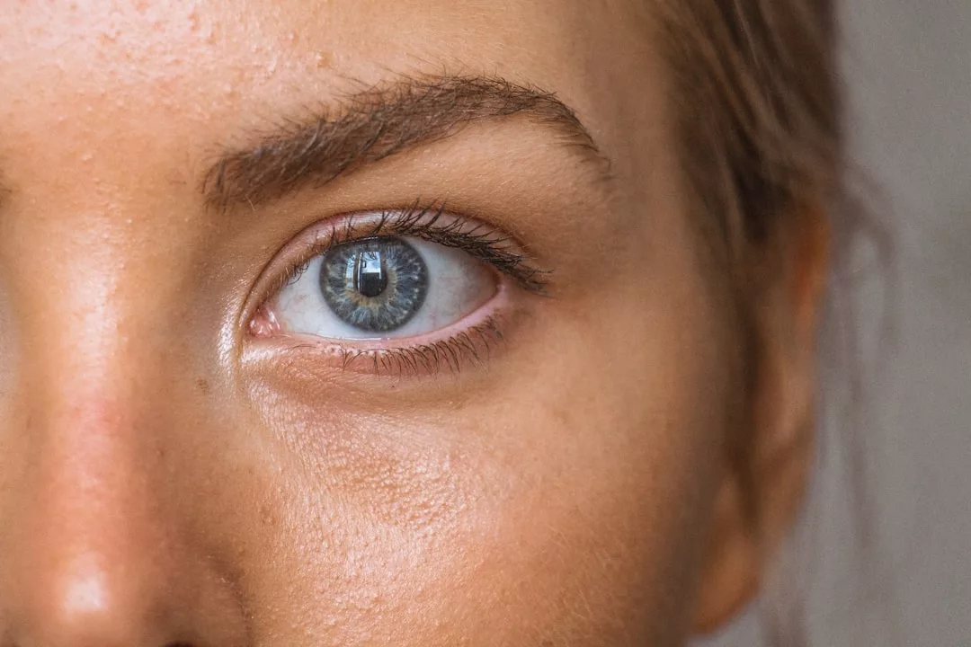 Photo Skin rejuvenation